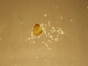 Crushed brown cysts with eggs are signs of soybean cyst nematode.Kaitlyn Bissonnette